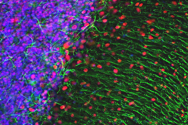 Anti-MeCP2 Antibody - Image 4