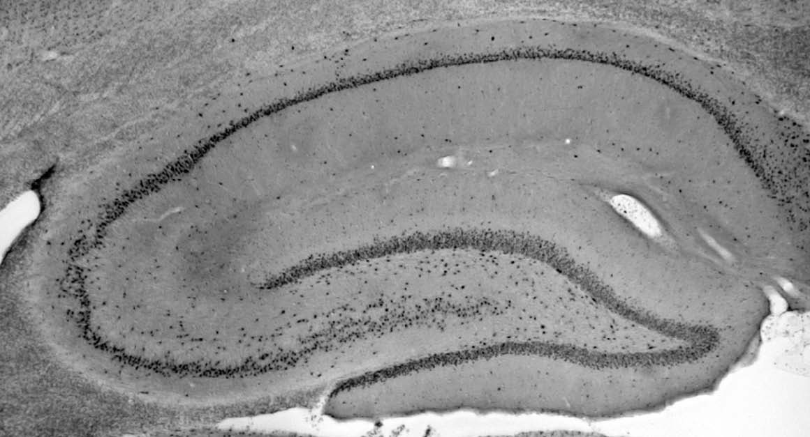 Anti-MECP2 Antibody