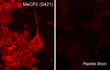 Anti-MeCP2 (Ser-421), Phosphospecific Antibody - Image 2
