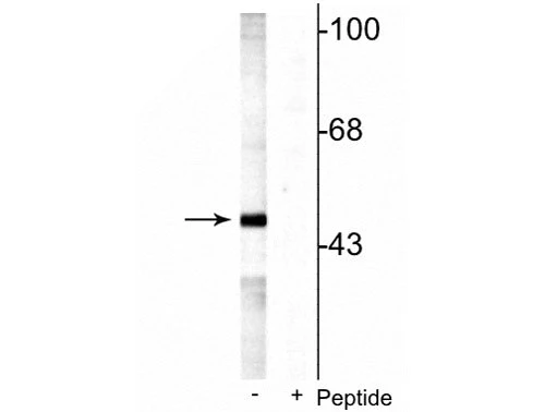 Anti-MEK5 (Ser311, Thr315) Antibody