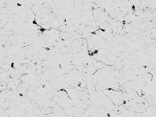 Anti-Melanocyte-stimulating hormone, alpha (Alpha-MSH) Antibody - Image 2