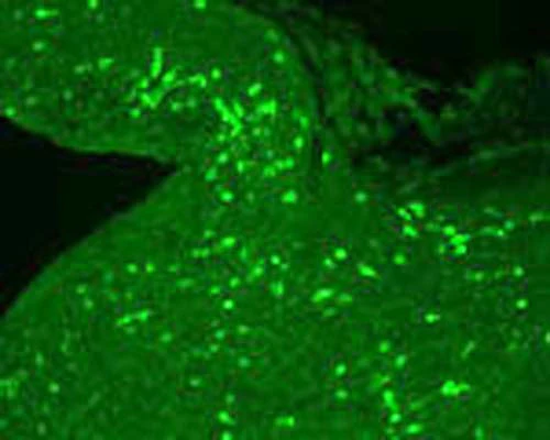 Anti-Melanocyte-stimulating hormone, gamma (Gamma-MSH) Antibody