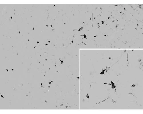 Anti-Melanocyte-stimulating hormone, gamma (Gamma-MSH) Antibody - Image 2