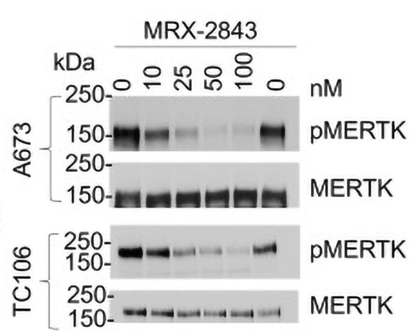 Anti-MerTK (Tyr749/753/754) Antibody - Image 4
