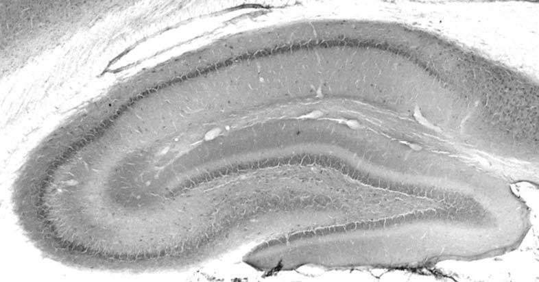 Anti-MESD Antibody