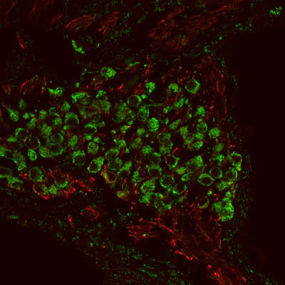 Anti-Metabotropic Glutamate Receptor Type 1 (mGluR1) Antibody - Image 3