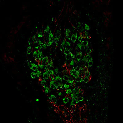 Anti-Metabotropic Glutamate Receptor Type 1 (mGluR1) Antibody - Image 4