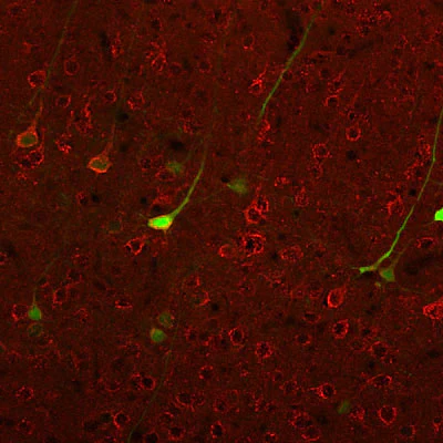 Anti-Metabotropic Glutamate Receptor Type 1 (mGluR1) Antibody - Image 5
