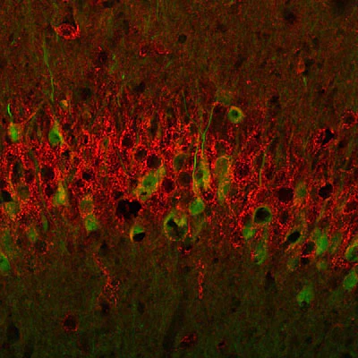 Anti-Metabotropic Glutamate Receptor Type 1 (mGluR1) Antibody - Image 6