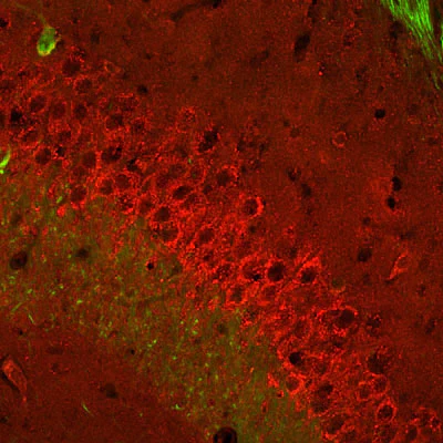 Anti-Metabotropic Glutamate Receptor Type 2/Type 3 (mGluR2/mGluR3) Antibody - Image 2