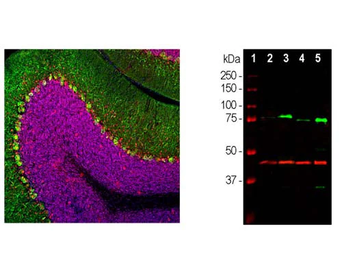 Anti-Methyl-CpG binding protein 2 (MeCP2) Antibody - Image 2