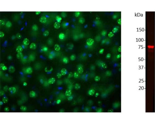 Anti-Methyl-CpG- binding protein 2 (MeCP2) Antibody