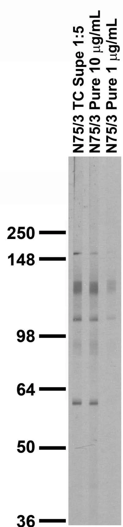 Anti-mGluR1/5 (Group I) Glutamate Receptor Antibody