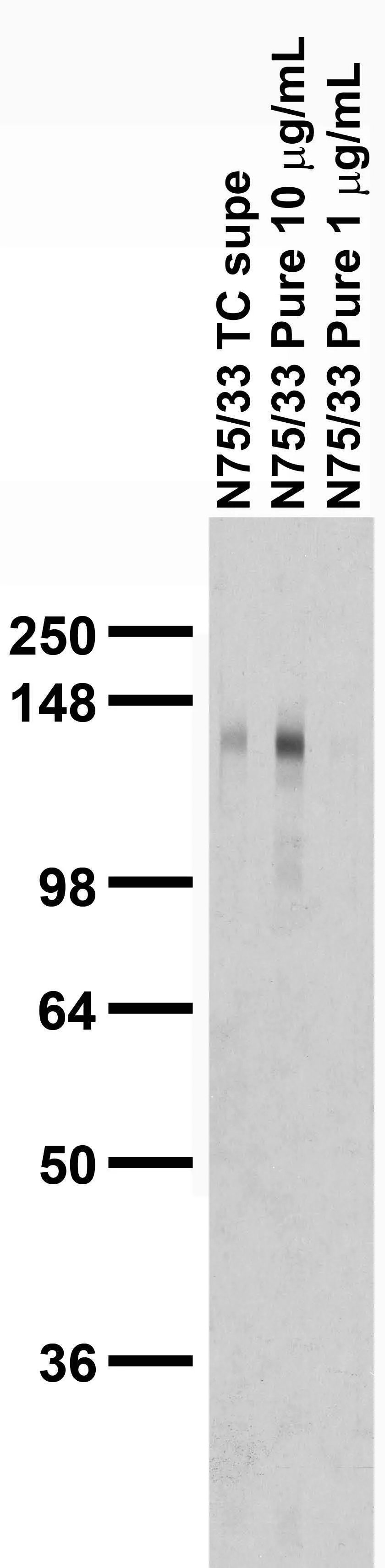 Anti-mGluR1/5 (Group I) Glutamate Receptor Antibody