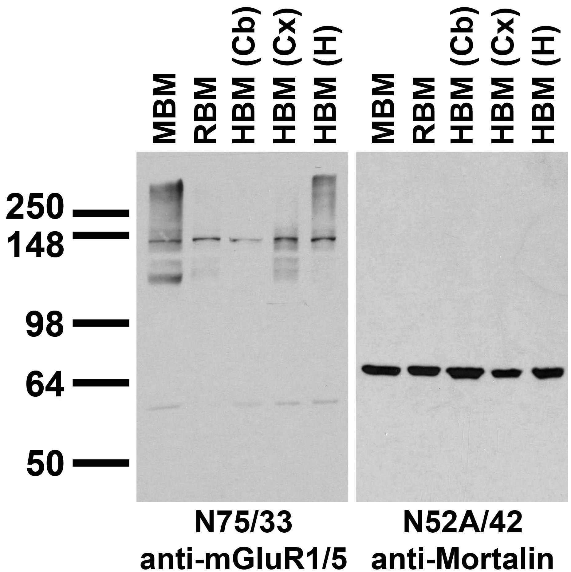 Anti-mGluR1/5 (Group I) Glutamate Receptor Antibody - Image 2