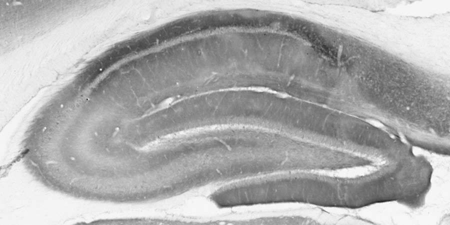 Anti-mGluR1/5 (Group I) Glutamate Receptor Antibody - Image 3