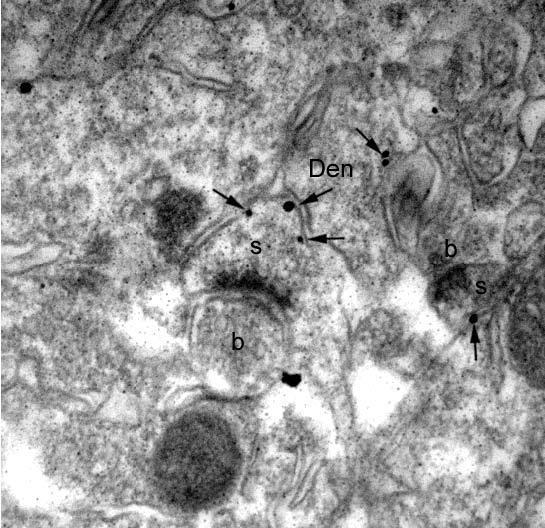 Anti-mGluR1/5 (Group I) Glutamate Receptor Antibody - Image 4