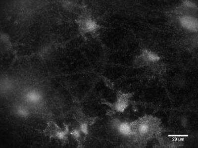 Anti-mGluR1 Antibody