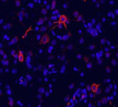 Anti-mGluR1 Antibody - Image 2