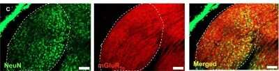 Anti-mGluR1 Antibody - Image 3