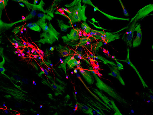 Anti-Microtubule Associated Protein 2 C/D (MAP2C/D) Antibody - Image 3