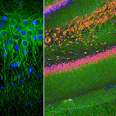 Anti-Microtubule Associated Protein 2 (MAP2) Antibody - Image 2