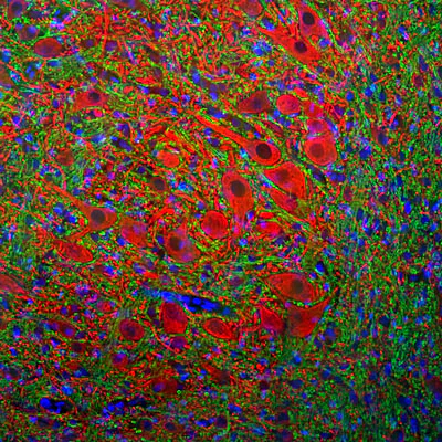 Anti-Microtubule Associated Protein 2 (MAP2) Antibody