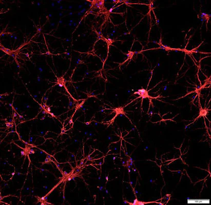 Anti-Microtubule Associated Protein 2 (MAP2) Antibody - Image 3