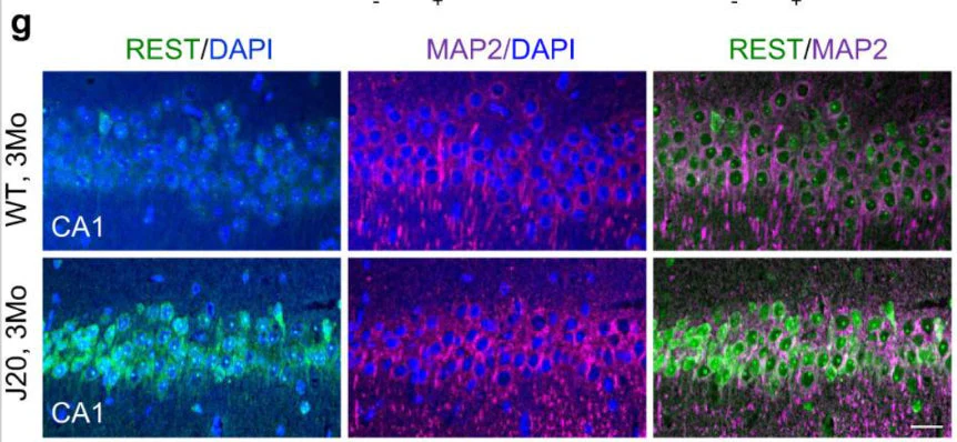 Anti-Microtubule Associated Protein 2 (MAP2) Antibody - Image 5