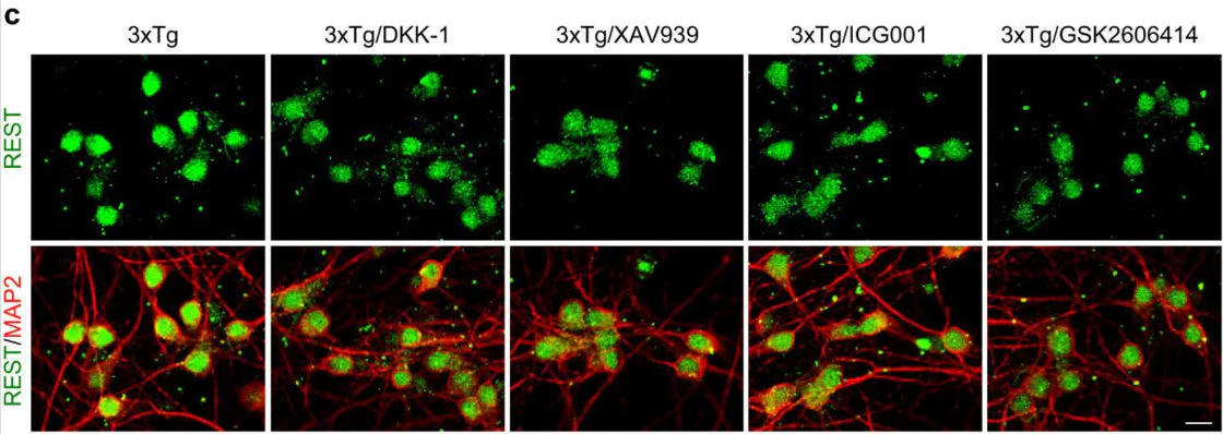 Anti-Microtubule Associated Protein 2 (MAP2) Antibody - Image 6
