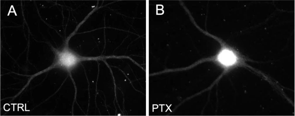 Anti-Microtubule Associated Protein 2 (MAP2) Antibody - Image 12