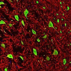 Anti-Microtubule Associated Protein 2 (MAP2) Antibody - Image 3
