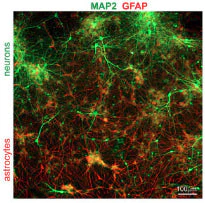 Anti-Microtubule Associated Protein 2 (MAP2) Antibody - Image 5