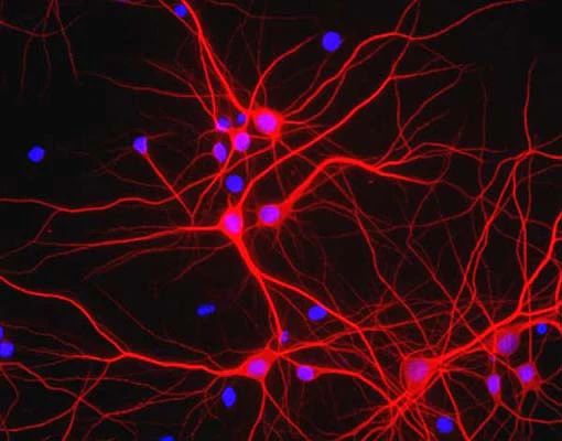 Anti-Microtubule-associated protein 2 (MAP2) Antibody