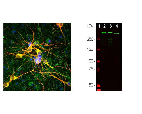 Anti-Microtubule-associated protein 2 (MAP2) Antibody - Image 2
