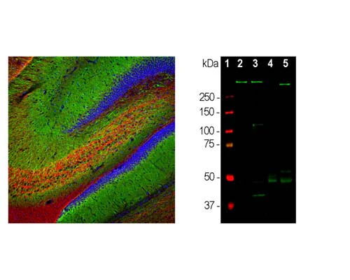 Anti-Microtubule Associated Protein 2 (MAP2) Antibody - Image 2