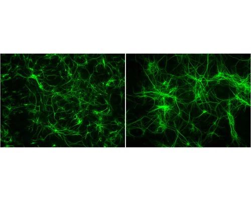 Anti-Microtubule Associated Protein 2 (MAP2) Antibody - Image 3