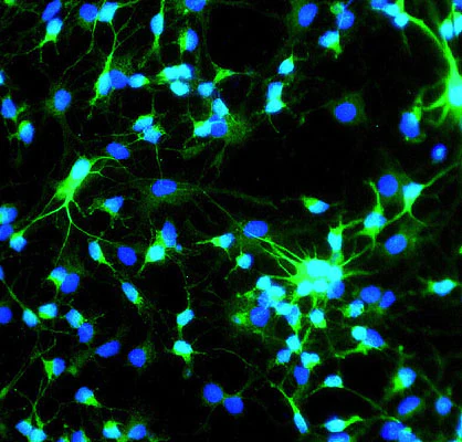 Anti-Microtubule-Associated Protein (MAP2) Antibody