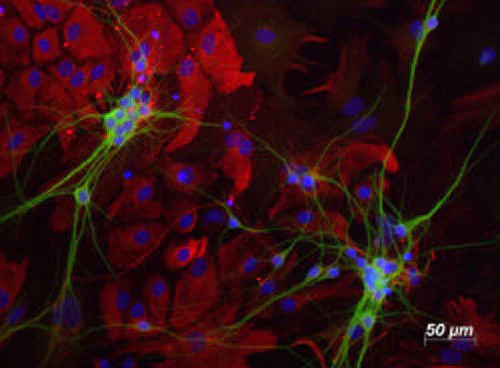 Anti-Microtubule-Associated Protein (MAP2) Antibody - Image 2