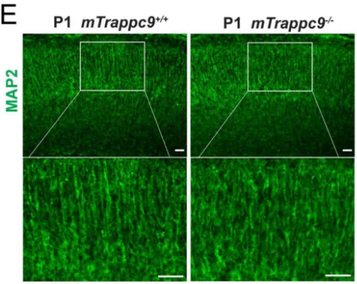 Anti-Microtubule-Associated Protein (MAP2) Antibody - Image 5