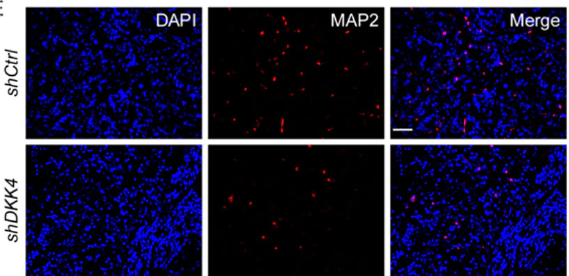 Anti-Microtubule-Associated Protein (MAP2) Antibody - Image 6