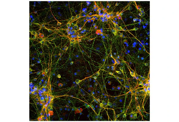Anti-Microtubule-associated protein tau (MAPT) Antibody