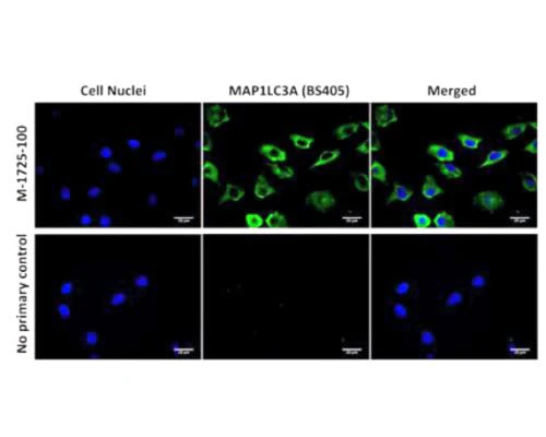 Anti-Microtubule-associated proteins 1A/1B light chain 3A (MAP1LC3A) Antibody - Image 2
