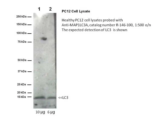 Anti-Microtubule-associated proteins 1A/1B light chain 3A (MAP1LC3A) Antibody - Image 2