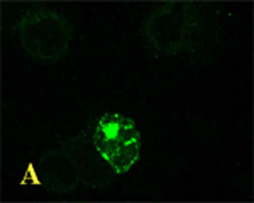 Anti-Microtubule-associated proteins 1A/1B light chain 3A (MAP1LC3A) Antibody - Image 3
