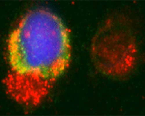Anti-Microtubule-associated proteins 1A/1B light chain 3A (MAP1LC3A) Antibody - Image 6