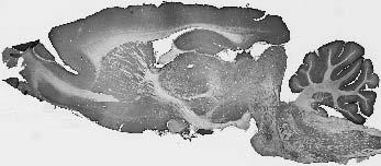 Anti-Miro2 Antibody - Image 2
