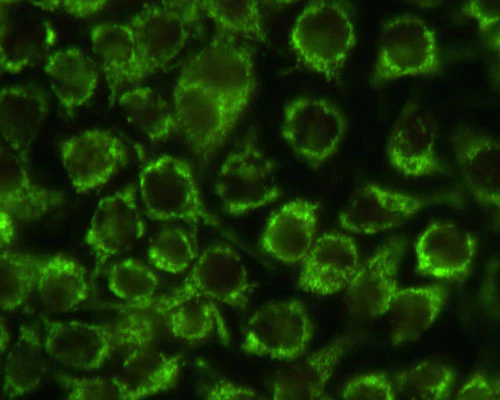 Anti-Mitochondria Antibody