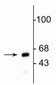 Anti-Mitochondria Antibody - Image 2