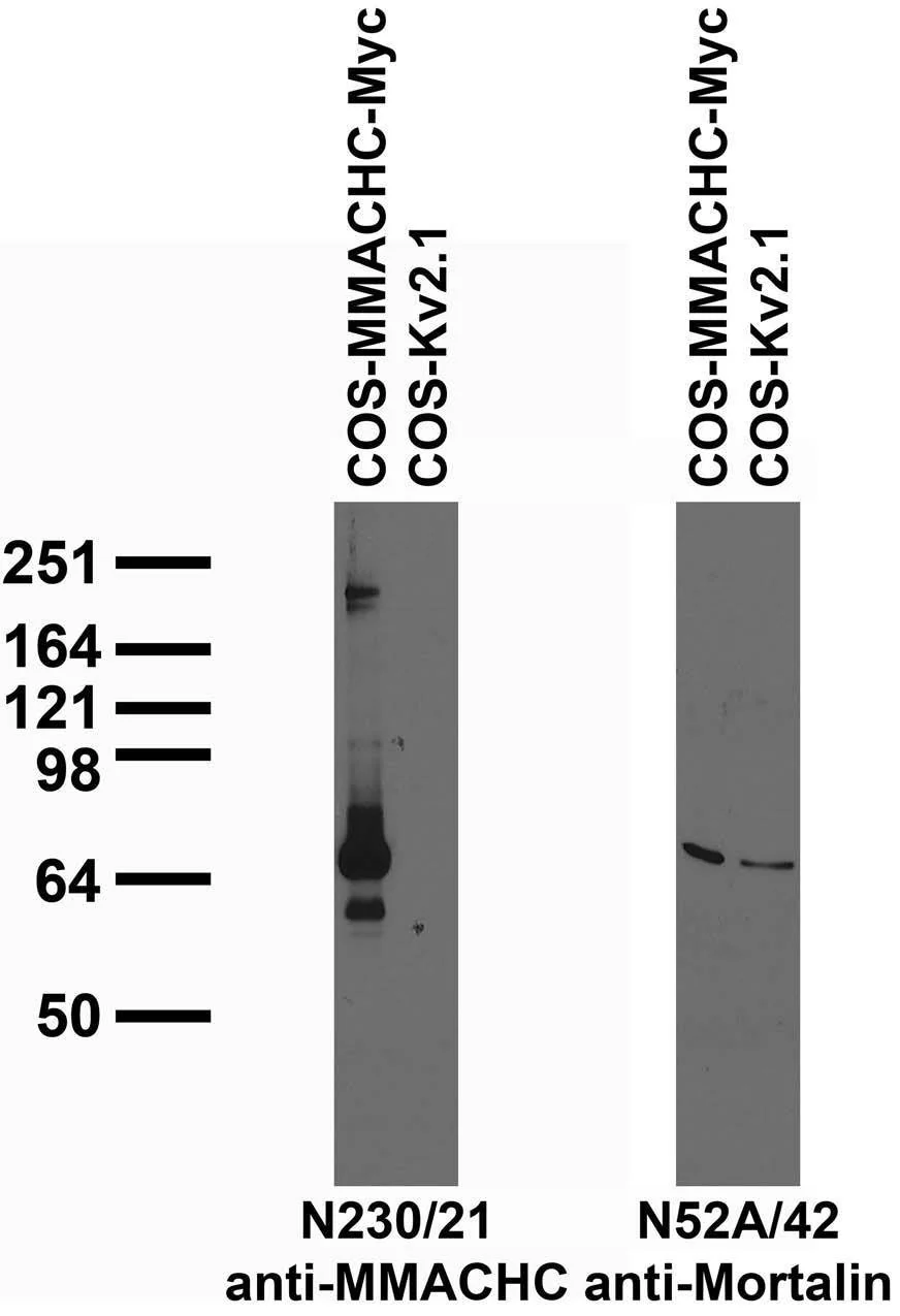 Anti-MMACHC Antibody